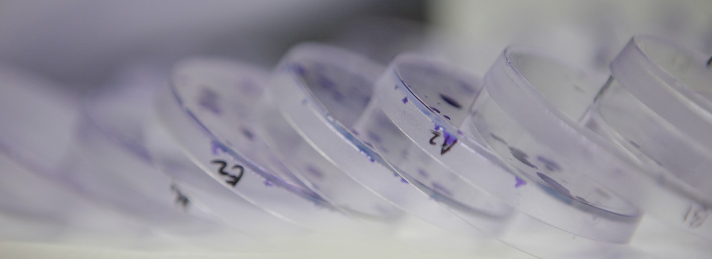 Plastic petri dishes stained with blue dye to reveal cells grown on their surface