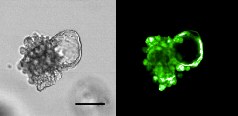 mouse tumor prostate cells grown in matrigel where there formed organoids