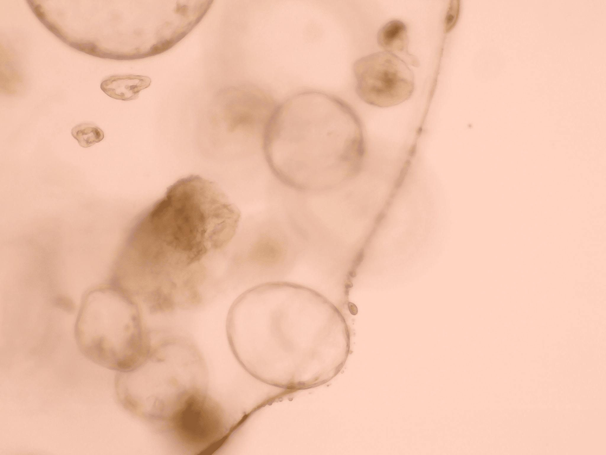 Microscopic image of a PEG implant at 18x magnification, highlighting surface features and structural details