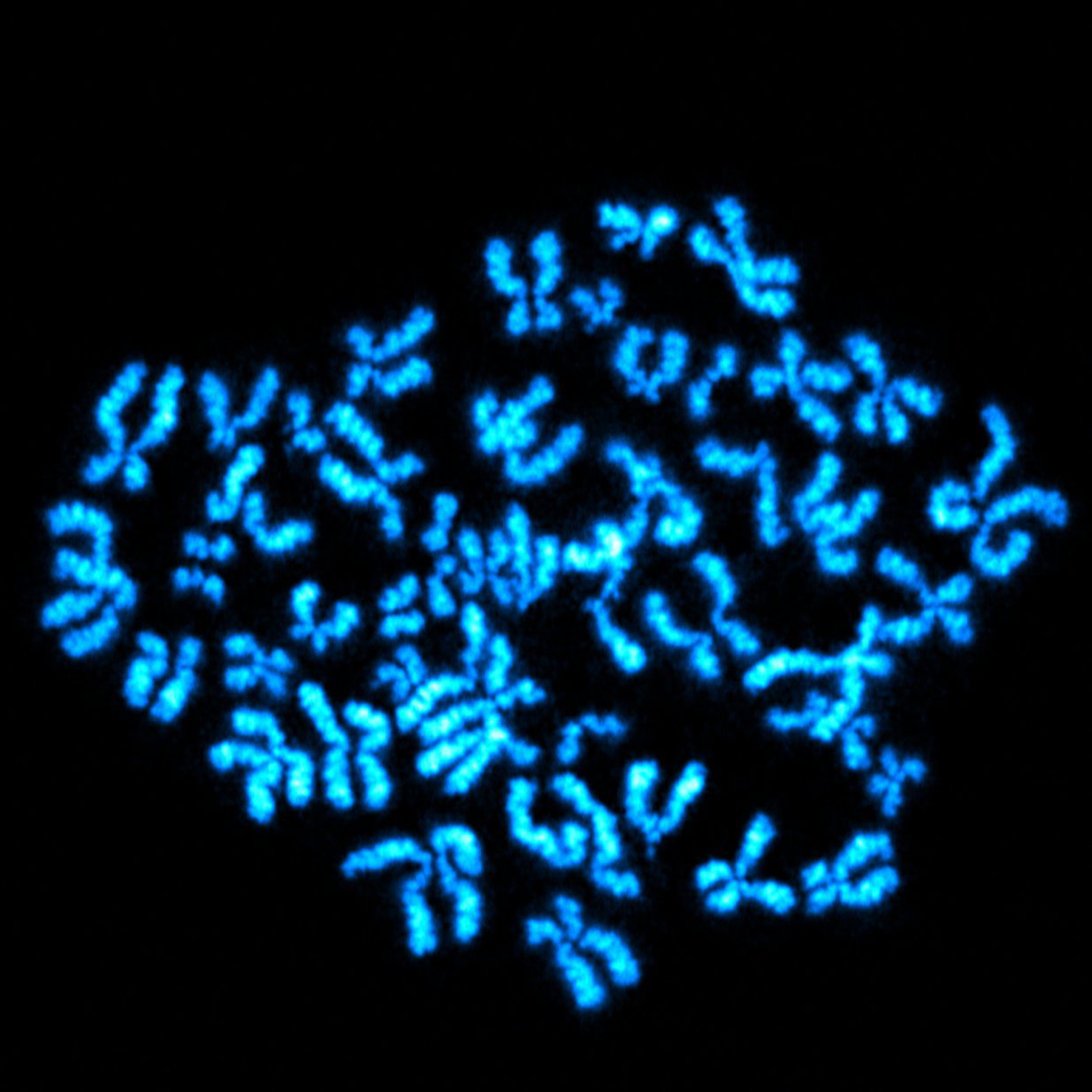 Chromosomes image used for scientific study
