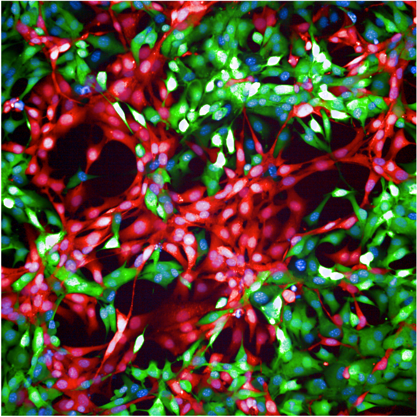 Microscopic image of pancreatic tissue, focusing on cellular structure and arrangement.