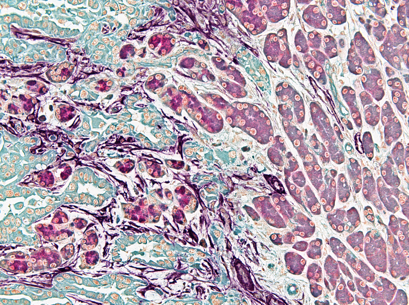 Microscopic image of pancreatic tissue, showcasing cellular structures and morphology