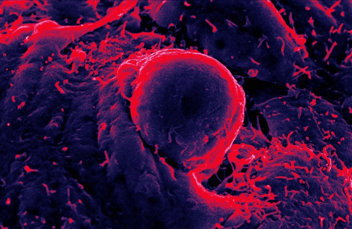 Images created by electron microscope of blood cells from mouse embryonic stem cells (credit to T.Allen & G.Lacaud).