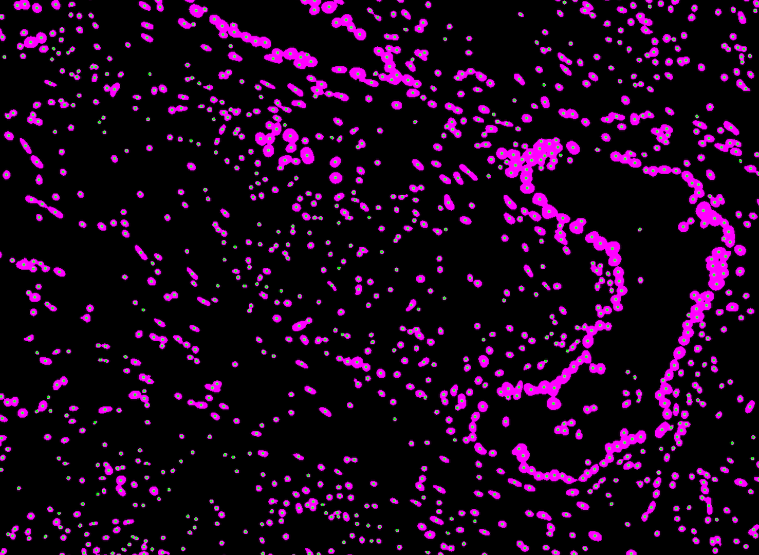 Image processing and segmentation image