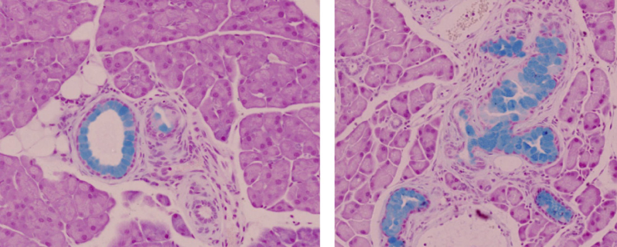 Histology images of pancreatic tissue