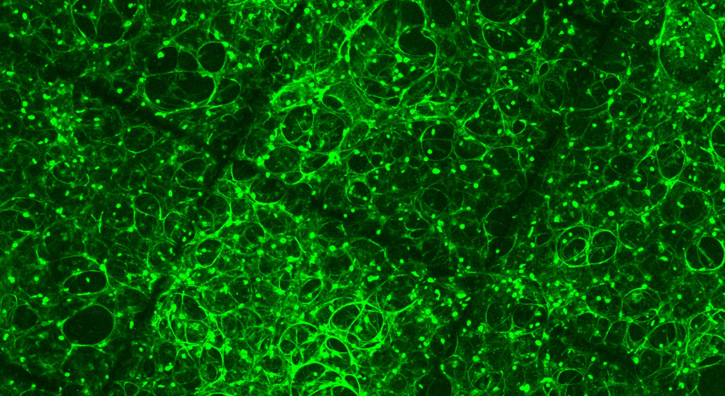 Fluorescent staining of lung cells, stained green
