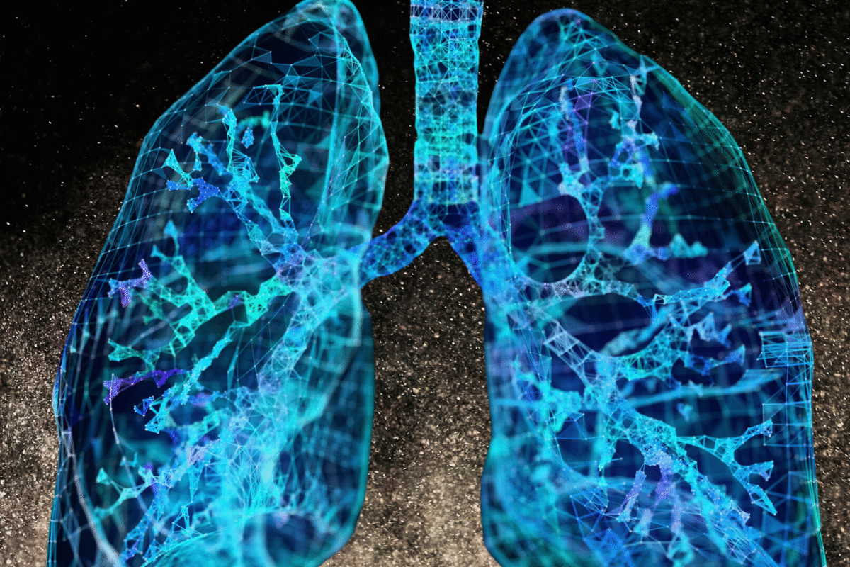CGI image of human lungs, superimposed on a background of grey particles