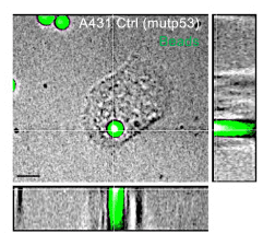 Figure supports how mutations in cancer gene p53 drive cell engulfment