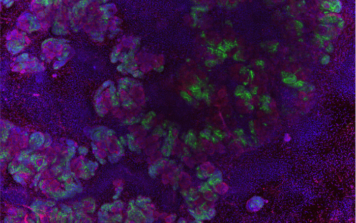 An immunofluorescence microscopy image of kidney tissue showing different tissue structures stained in red, blue, and green The blue colour (DAPI) is widespread, indicating the location of cell nuclei throughout the sample. The green colour (LTL) highlights specific regions, indicating the presence of proximal tubule cells. The red colour (NPHS1) is also distinct in certain areas, showing the presence of podocytes in the glomeruli. The overlapping colours in some regions suggest the complex structure and the close association of these different cell types within the kidney.