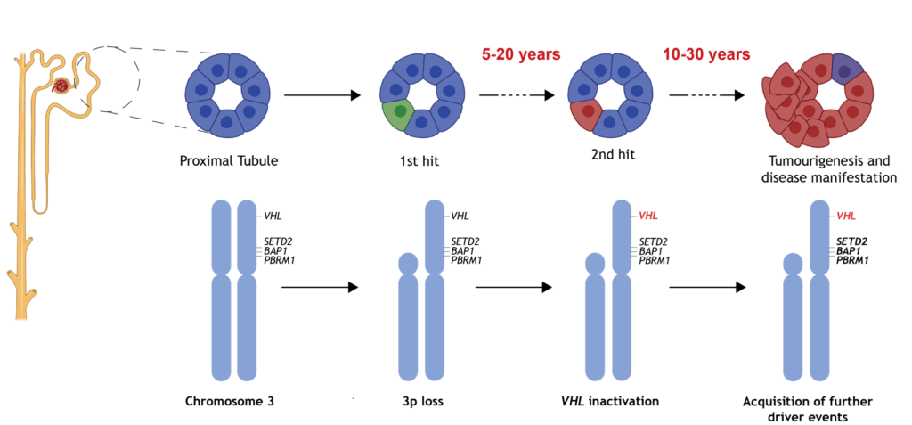 Schematic showing how kidney cancer develops. Cells acquire an initial VHL mutation at birth, lose the remaining healthy VHL copy years later, and then accumulate further genetic changes that eventually lead to tumour formation.